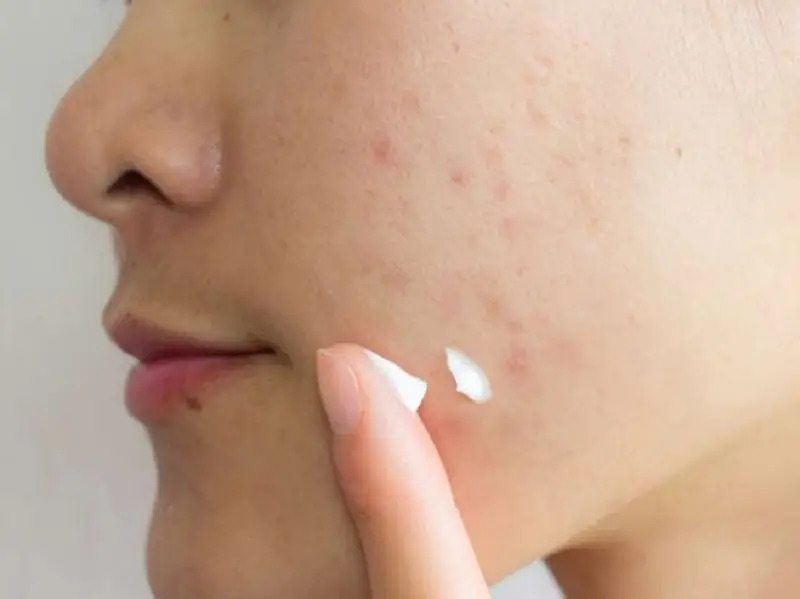 Thoa kem đều đặn hàng ngày để mang lại kết quả tốt nhất