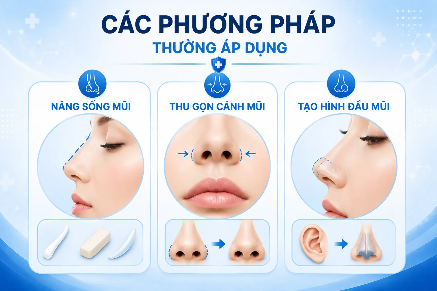 Các Phương Pháp Thường Áp Dụng để chỉnh sửa dáng mũi lân là nâng cao sống mũi, thu gọn cánh mũi, tạo hình đầu mũi