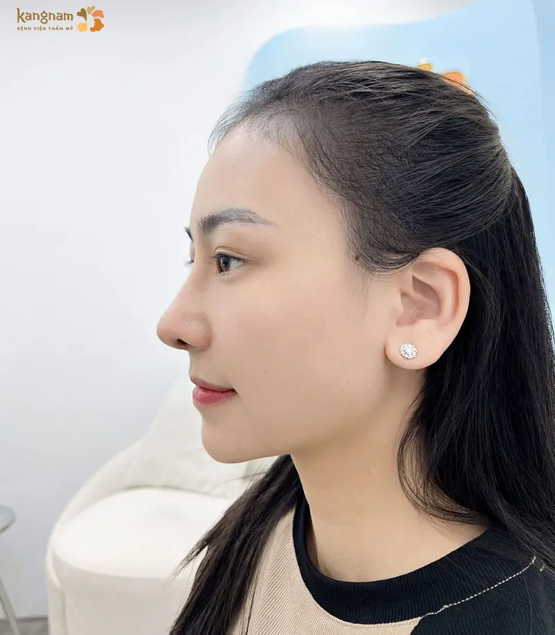 Dễ dàng điều chỉnh dáng mũi