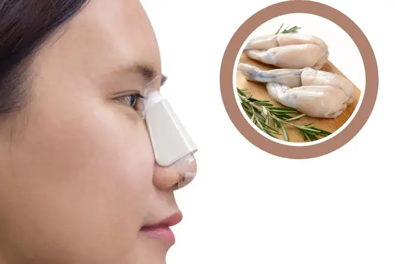 Không nên ăn thịt ếch sau khi vừa nâng mũi
