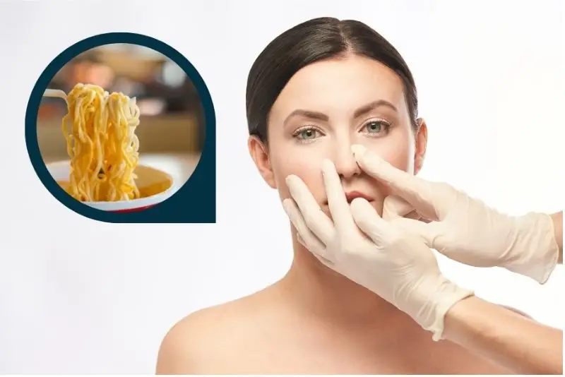 Không nên ăn mì tôm sau nâng mũi