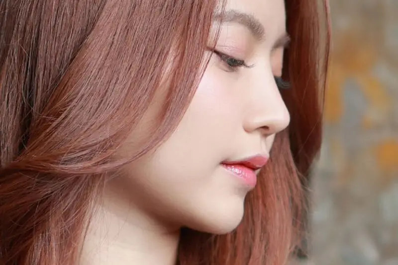 Nâng mũi bằng trung bì mỡ duy trì kết quả từ 3 - 5 năm