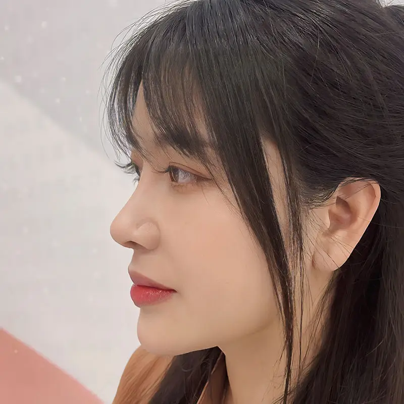 Dáng mũi hài hòa với tỷ lệ gương mặt