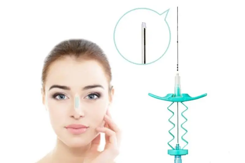 Nâng mũi chỉ Hiko là phương pháp không phẫu thuật