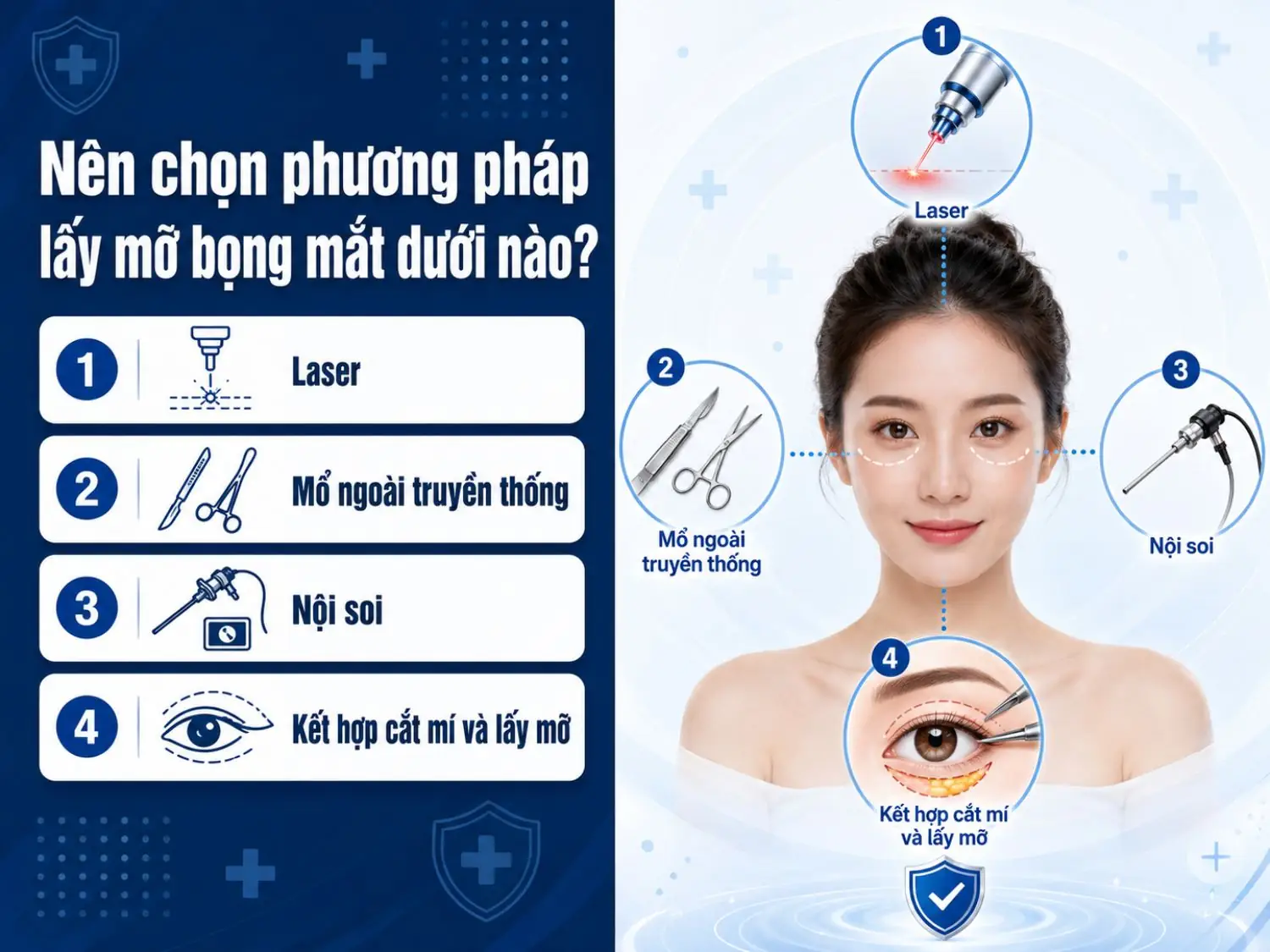Nên chọn phương pháp lấy mỡ bọng mắt dưới nào với 4 lựa chọn phổ biến gồm laser, mổ ngoài truyền thống, nội soi và kết hợp cắt mí lấy mỡ.