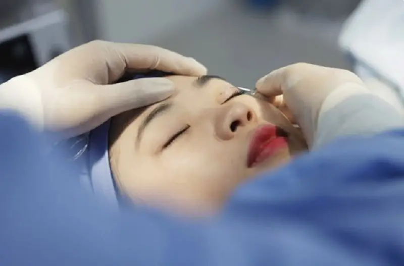 Nên lựa chọn địa chỉ nhấn mí uy tín, có bác sĩ giỏi chuyên môn