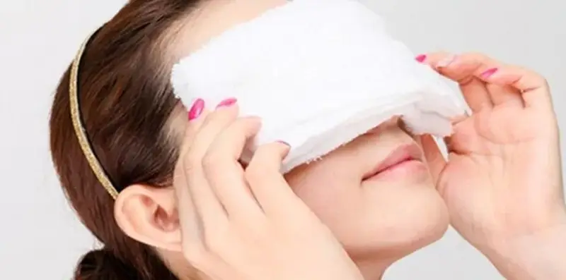 Khách hàng có thể chườm lạnh sau khi nhấn mí để giảm thiểu triệu chứng khó chịu