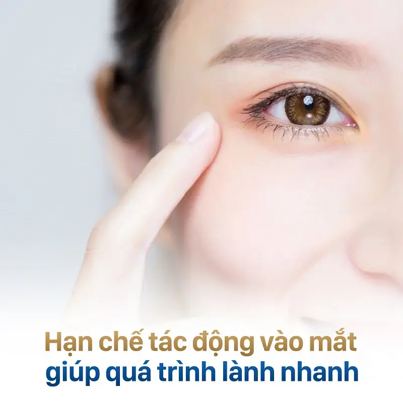 Không nên tác động mạnh vào mí mắt