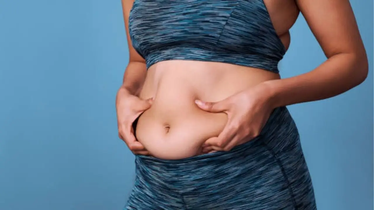 tình trạng Mỡ bụng tích ở vùng bụng phía dưới rốn