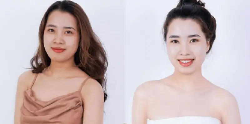 Thực hiện tắm trắng công nghệ cao tại cơ sở uy tín sẽ giúp chị em sở hữu làn da trắng sáng, mịn màng