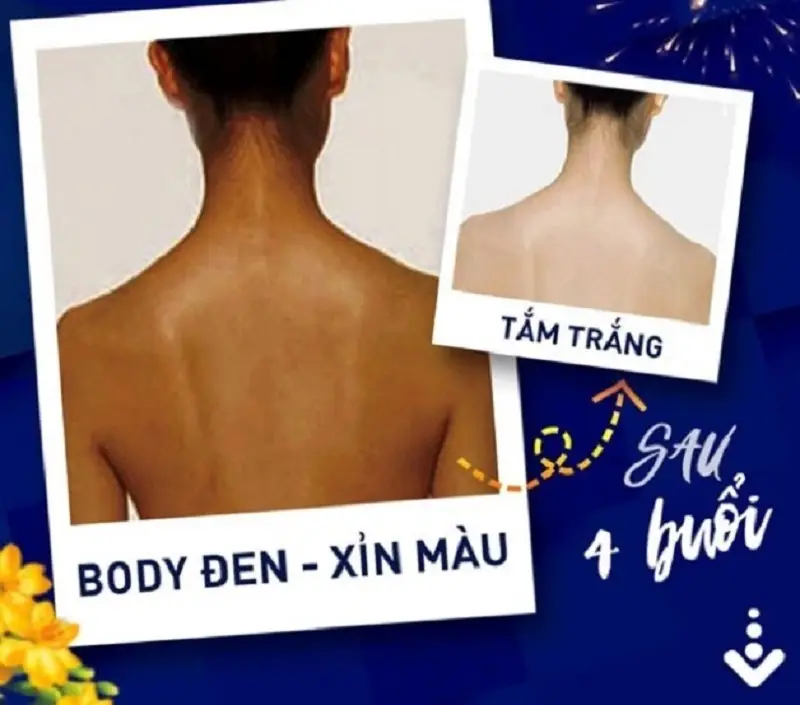 Khách hàng thay đổi màu da rõ rệt sau vài buổi tắm trắng