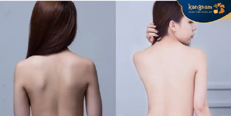 Khách hàng sở hữu làn da trắng sáng bật tone