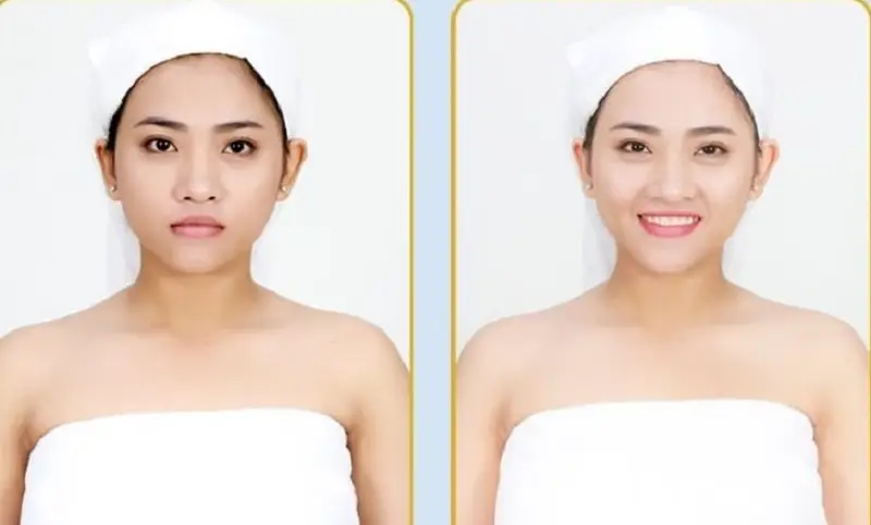 Tùy thuộc vào gói tắm trắng ở mỗi cơ sở sẽ có mức giá khác nhau