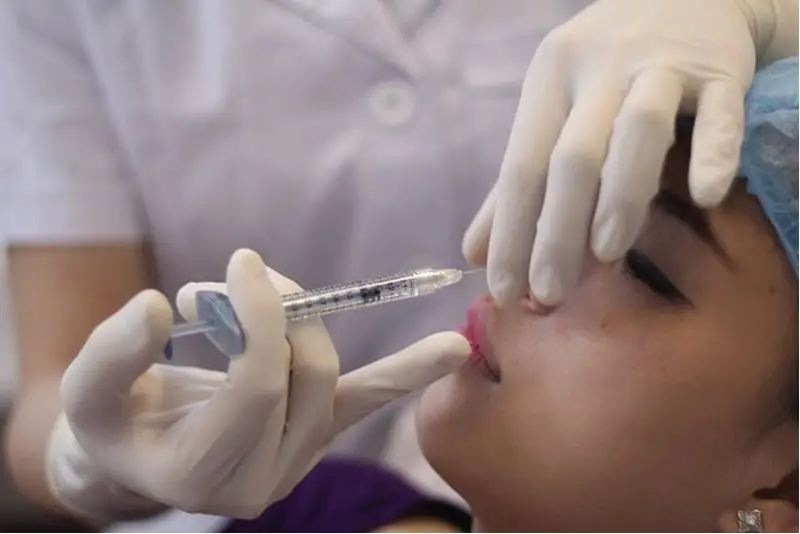 Tiêm filler mũi tan hết sau 6 - 24 tháng