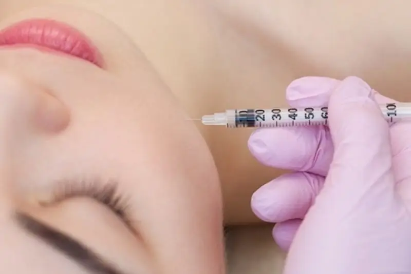 Tiêm filler nên chọn địa chỉ uy tín, thực hiện tần suất phù hợp