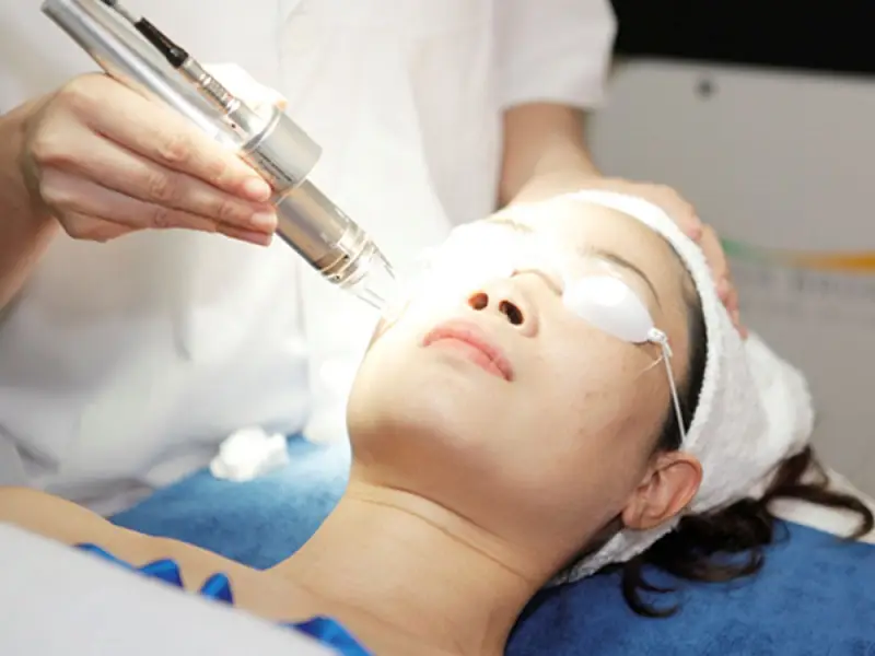 Tia laser có tác động lên vùng da bị sẹo lõm