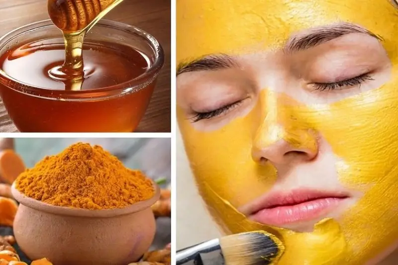 Trị sẹo lõm bằng phương pháp tự nhiên từ mật ong và nghệ giúp hỗ trợ lấp đầy sẹo