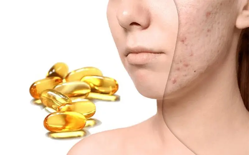 Uống lượng vitamin E vừa đủ để tránh gây tác dụng phụ