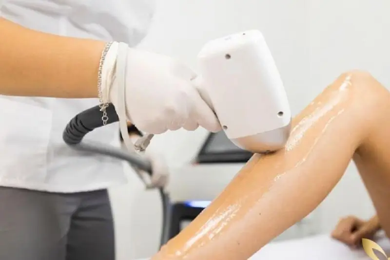 Triệt lông bằng công nghệ Diode Laser là phương pháp an toàn và không gây hại