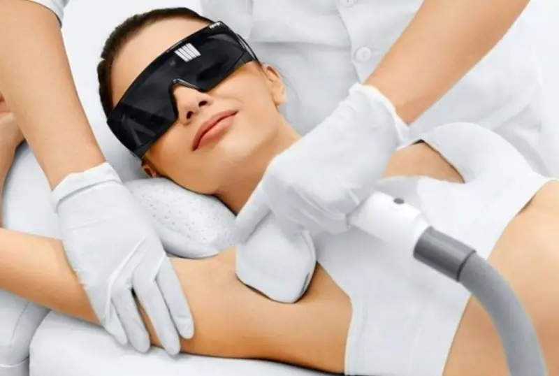Dùng tia laser để điều trị tình trạng hôi nách