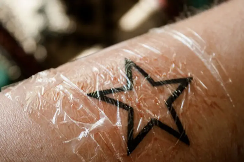 Giữ miếng băng gạc tại chỗ trong vài giờ đầu