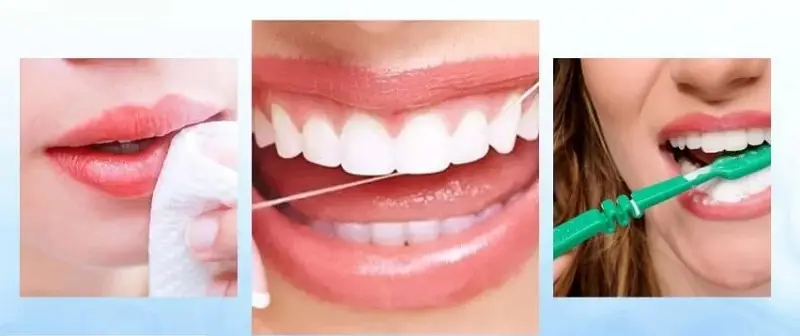 Có thể dùng chỉ nha khoa để làm sạch mảng bám thức ăn