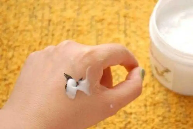 Xóa xăm bằng kem lạnh