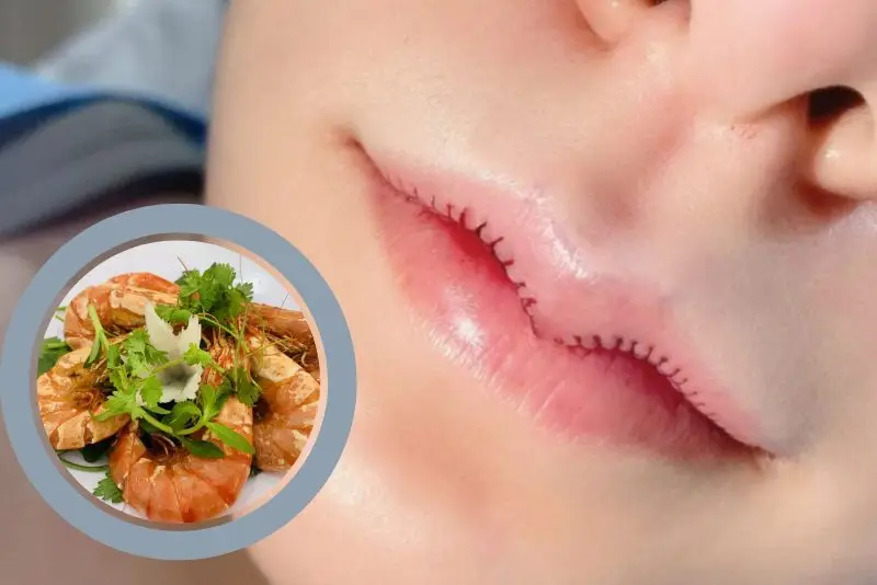 Kiêng hải sản sau khi cắt môi tim