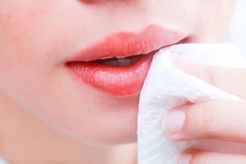 Nên vệ sinh môi sạch sẽ bằng nước muối sinh lý