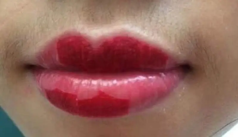 Môi có thể bong sau 2 ngày