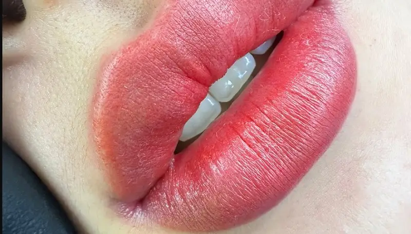 Hình ảnh môi sau phun 1 ngày, sẽ gặp tình trạng sưng tấy