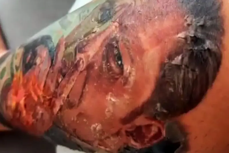 Hình xăm đóng vảy sau 3-5 ngày và bong sau từ 7-14 ngày