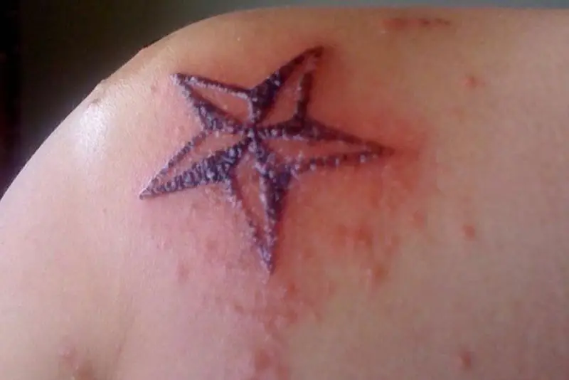 Dấu hiệu hình xăm bị viêm nhiễm