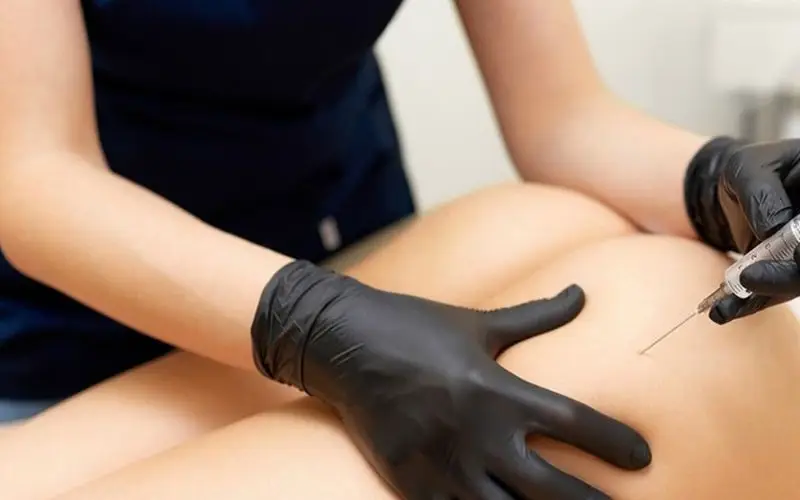 Hiệu quả của filler không mang lại hiệu quả vĩnh viễn