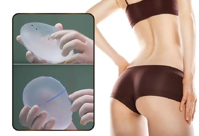 Dùng túi độn giúp vòng 3 to tròn, quyến rũ hơn