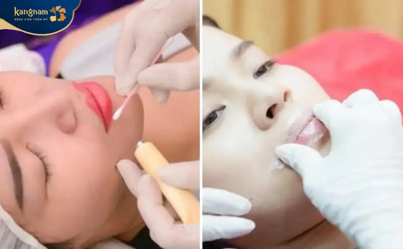 Trước khi phun môi chị em sẽ được ủ tê