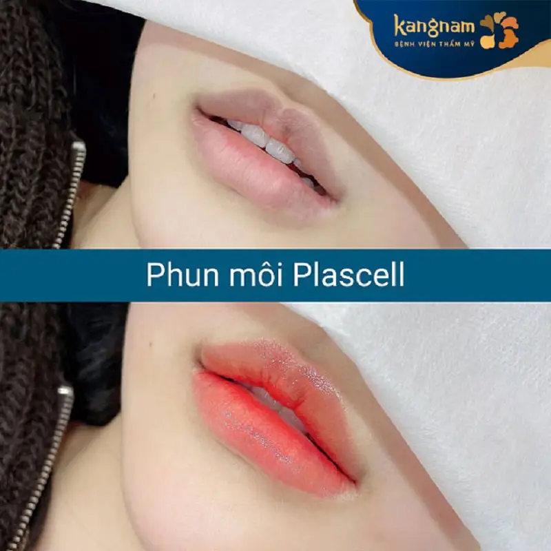 Phun môi giá bao nhiêu phụ thuộc vào công nghệ thực hiện