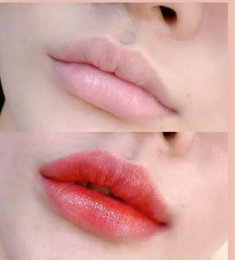 Phun môi xí muội cũng giúp khắc phục đôi môi xỉn màu