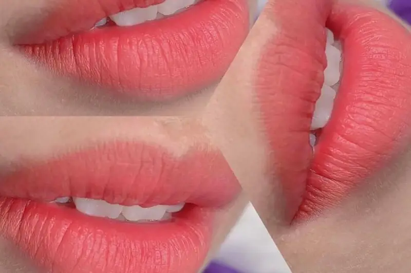 Sau khi phun môi sẽ bị sưng và có màu đậm hơn bình thường