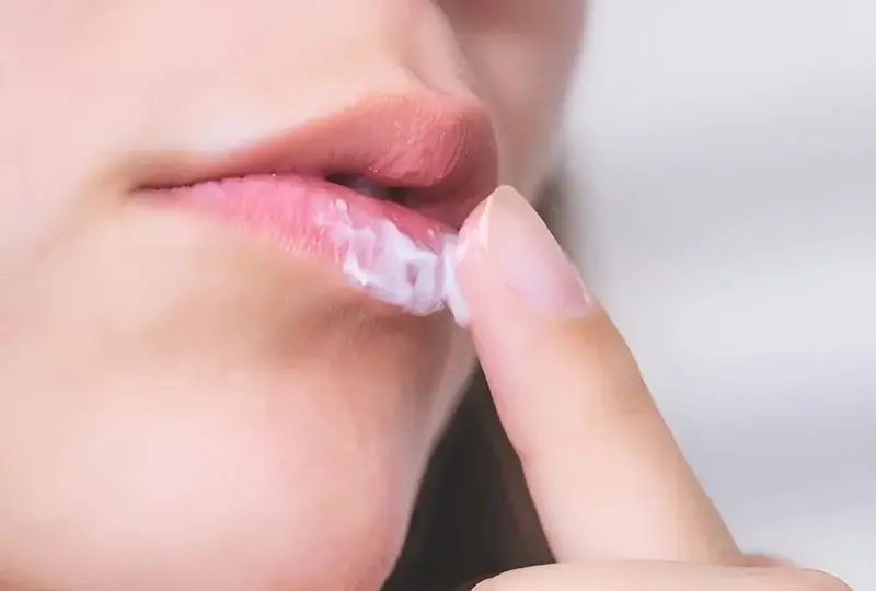 Thực hiện bôi thuốc mỡ lên môi từ 2 - 3 lần mỗi ngày