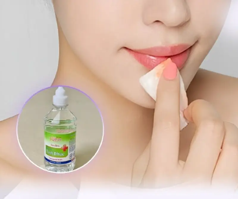 Vệ sinh môi sạch sẽ bằng nước muối sinh lý