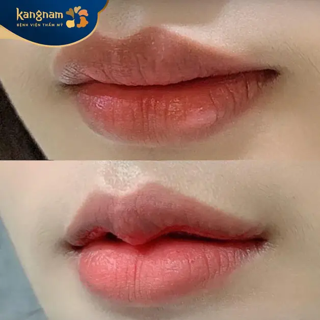 Tạo môi trái tim tự nhiên, quyến rũ