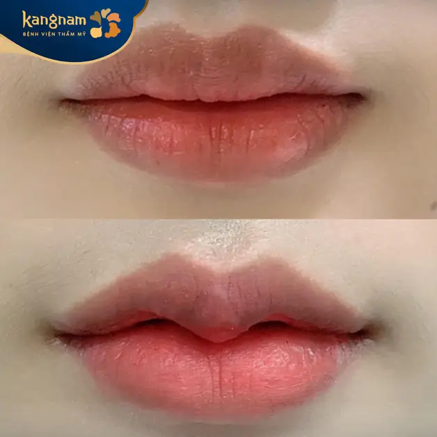 Chăm sóc tốt giúp môi vào form tự nhiên