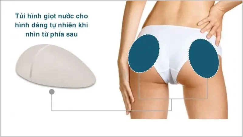 Túi tạo dáng tự nhiên khi nhìn từ phía sau