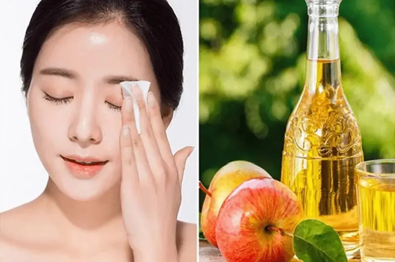 Cách trị mụn thịt ở mắt bằng giấm táo được nhiều người áp dụng
