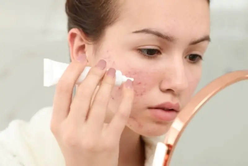 Các sản phẩm bôi ngoài như serum hay kem trị thâm thường chứa các hoạt chất có khả năng ức chế melanin