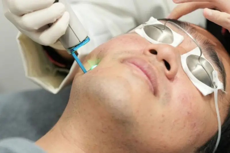 Điều trị thâm mụn bằng laser, đặc biệt là công nghệ hiện đại như Picosure hoặc Picosure Pro sử dụng xung ánh sáng cực ngắn để phá vỡ hắc tố melanin