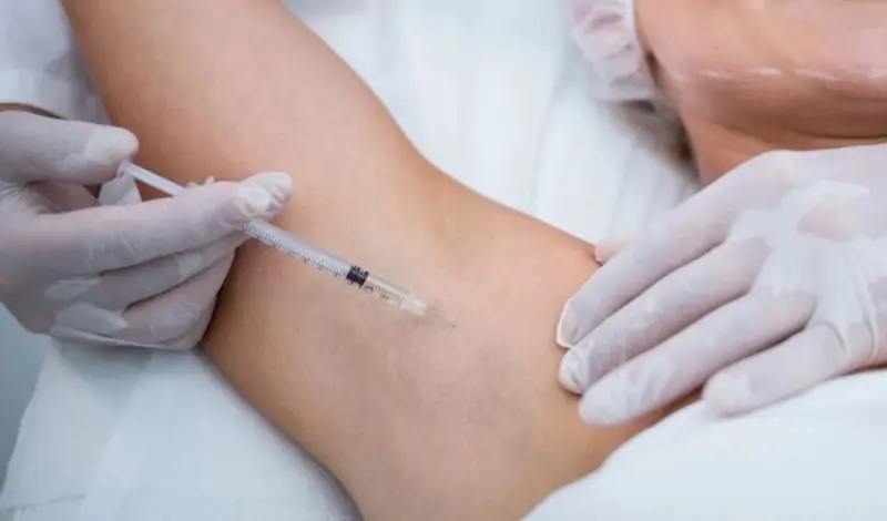 Tiêm botox giúp giảm thiểu hoạt động của tuyến mồ hôi