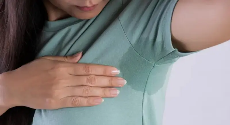Hôi nách 1 bên nguyên nhân do tuyến mồ hôi hoạt động quá mức