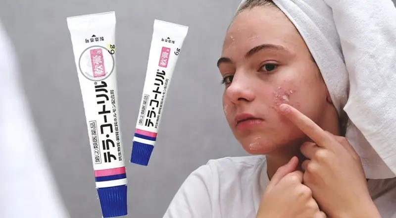 Kem trị mụn Tera Kotoriru có thể ngăn ngừa mụn hình thành